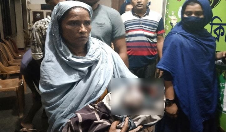 চাঁপাইনবাবগঞ্জের সেই বিরল শিশুটি মারা গেছে  