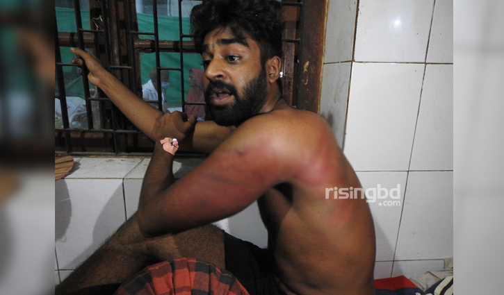 অ্যাসাইনমেন্ট জমা দিতে গিয়ে বেদম মারপিটে কলেজছাত্র আহত অ্যাসাইনমেন্ট জমা দিতে গিয়ে বেদম মারপিটে কলেজছাত্র আহত