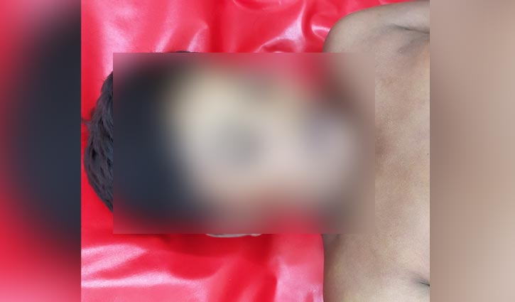 কুমিল্লায় সাপের কামড়ে শিশুর মৃত্যু