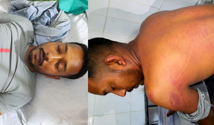 বাগেরহাটে ঠিকাদারের প্রতিনিধিকে মারধরের অভিযোগ বাগেরহাটে ঠিকাদারের প্রতিনিধিকে মারধরের অভিযোগ