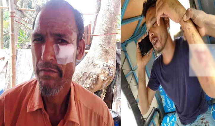 বাগেরহাটে নির্বাচনি সহিংসতায় প্রার্থীসহ আহত ৬ বাগেরহাটে নির্বাচনি সহিংসতায় প্রার্থীসহ আহত ৬
