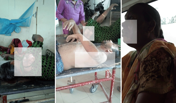 বগুড়ার গ্যাস সিলিন্ডার বিস্ফোরণ, দগ্ধ ৪ বগুড়ার গ্যাস সিলিন্ডার বিস্ফোরণ, দগ্ধ ৪