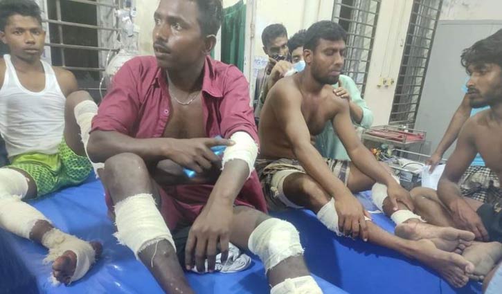 ২ ইউপি সদস্য প্রার্থীর সমর্থকদের মধ্যে সংঘর্ষ, আহত ১৫ ২ ইউপি সদস্য প্রার্থীর সমর্থকদের মধ্যে সংঘর্ষ, আহত ১৫
