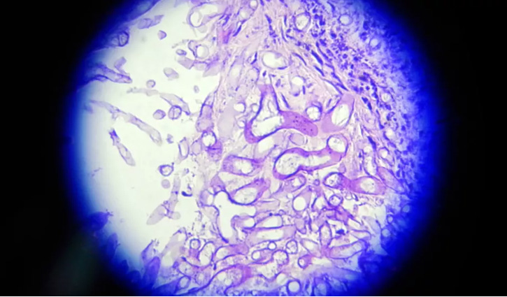 ব্ল্যাক ফাঙ্গাস থেকে সুরক্ষার উপায়