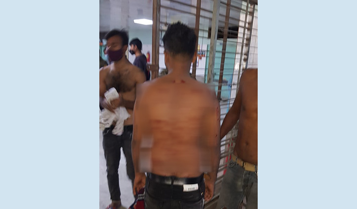 টঙ্গীতে আহত ৮ পোশাক শ্রমিক ঢামেকে ভর্তি টঙ্গীতে আহত ৮ পোশাক শ্রমিক ঢামেকে ভর্তি