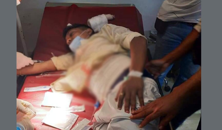 কক্সবাজারে সাবেক ছাত্রলীগ নেতাসহ দুইজন গুলিবিদ্ধ কক্সবাজারে সাবেক ছাত্রলীগ নেতাসহ দুইজন গুলিবিদ্ধ