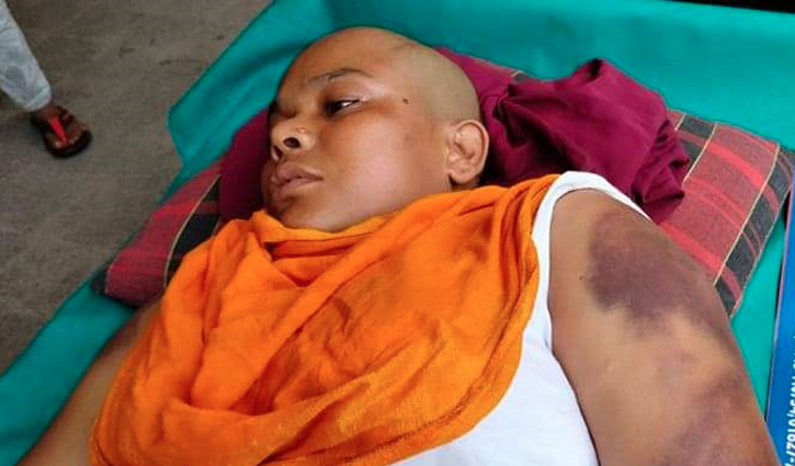 সাভারে গৃহকর্মীকে নির্যাতন, ব্যবস্থা নেয়নি পুলিশ সাভারে গৃহকর্মীকে নির্যাতন, ব্যবস্থা নেয়নি পুলিশ