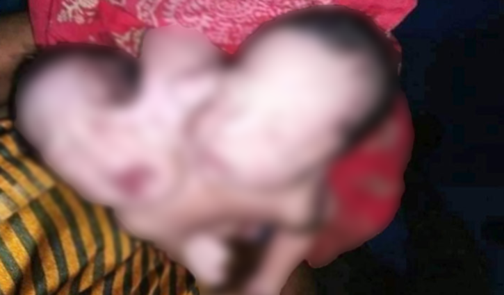 কুড়িগ্রামে দুই মাথা নিয়ে কন্যা শিশুর জন্ম কুড়িগ্রামে দুই মাথা নিয়ে কন্যা শিশুর জন্ম