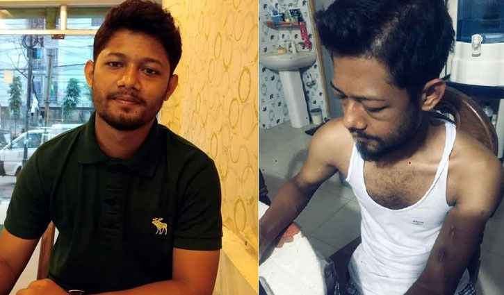 দুটি কিডনিই বিকল, হৃৎপিণ্ডে পানি: তবুও বাঁচার আশা ছাড়েননি নাহিদ দুটি কিডনিই বিকল, হৃৎপিণ্ডে পানি: তবুও বাঁচার আশা ছাড়েননি নাহিদ