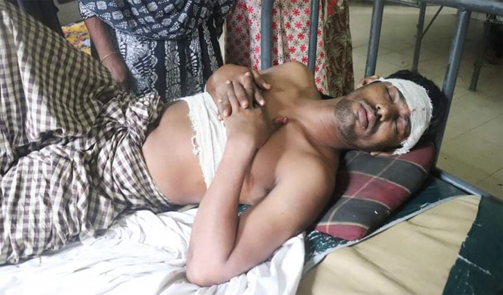 রাতে প্রেমিকার বাড়িতে গিয়ে রক্তাক্ত হলেন প্রেমিক রাতে প্রেমিকার বাড়িতে গিয়ে রক্তাক্ত হলেন প্রেমিক