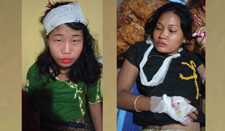 বান্দরবানে পর্যটকবাহী বাসে গুলি, আহত ২ বান্দরবানে পর্যটকবাহী বাসে গুলি, আহত ২