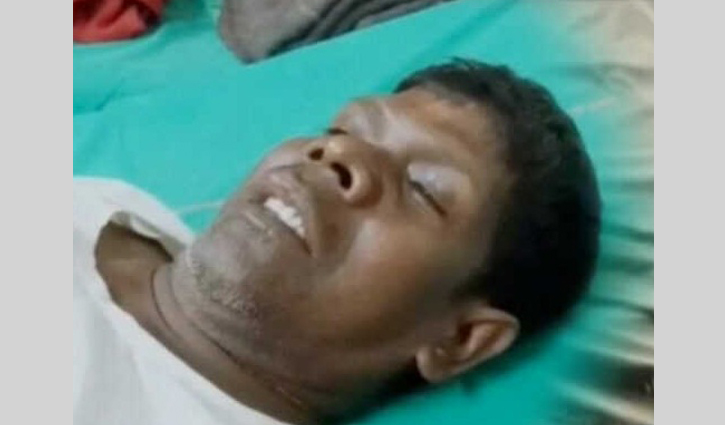 গাড়ি চালানো শিখতে গিয়ে আহত কাঁচা বাদাম’র গায়ক