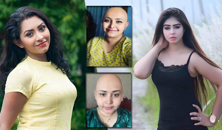 অভিনেত্রীদের হঠাৎ মাথা ন্যাড়া করার কারণ কী?