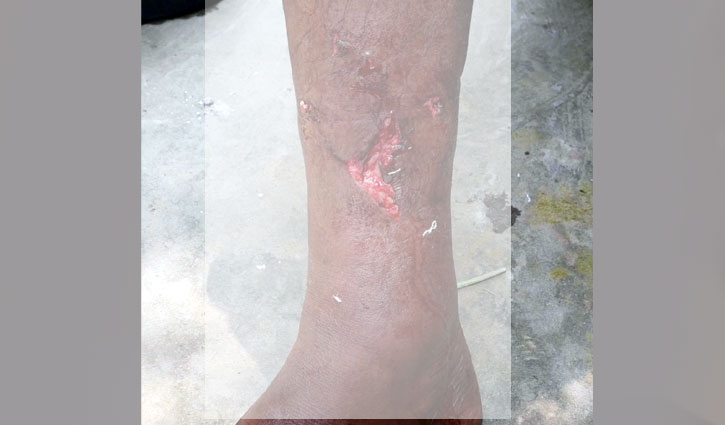 অচেনা হিংস্র প্রাণি নয়, পাগলা কুকুরের কামড়ে আহত অর্ধশতাধিক