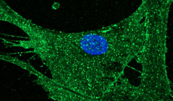Scientists rejuvenate skin cells by 30 years Scientists rejuvenate skin cells by 30 years