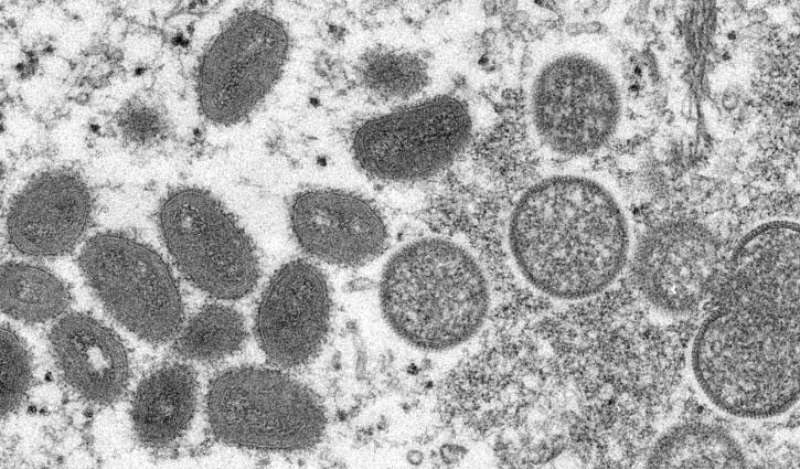 Monkeypox Virus: All ports put on alert