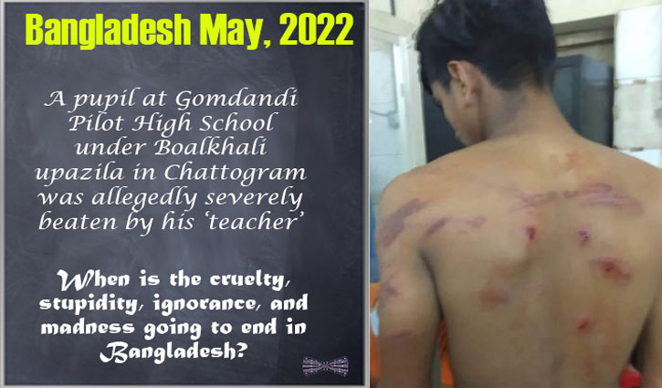 Corporal punishment impairs a child’s development