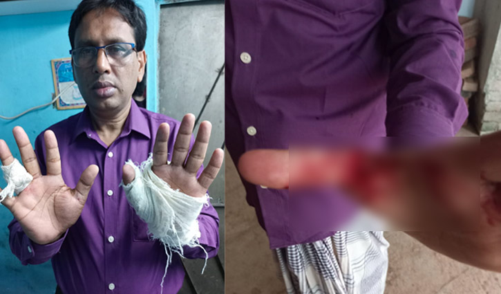 জামিনে বের হয়ে শিক্ষা কর্মকর্তাকে হাতুড়ি পেটা