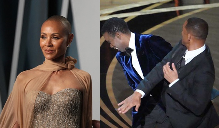 অস্কারে থাপ্পড়-কাণ্ডের পর আলোচনায় অ্যালোপেশিয়া, কেন হয় এই রোগ