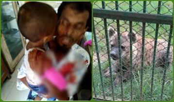 জাতীয় চিড়িয়াখানায় শিশুর হাত খেয়ে ফেলেছে হায়েনা