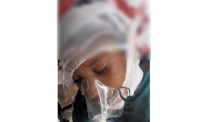 মহাখালীতে উড়ালসড়ক থেকে পড়া রড মাথায় ঢুকে শিশুর মৃত্যু