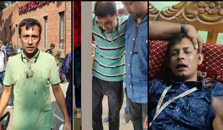 20 newsmen injured during clash