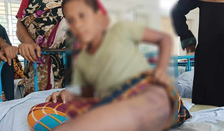 অসুস্থ মাদ্রাসা শিক্ষার্থীকে হাত-পা বেঁধে বেদম মার, শিক্ষক পলাতক