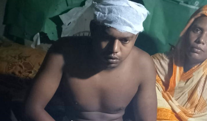 ফল বিক্রেতাকে কুপিয়ে জখম, ৬ দিনেও মামলা হয়নি 