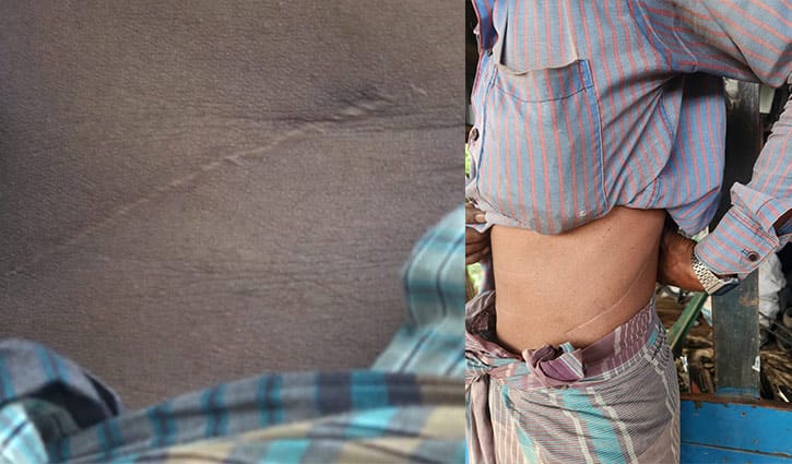 তরুণের কিডনির দাম ৭ লাখ টাকা, মধ্যবয়সীর ২ লাখ 