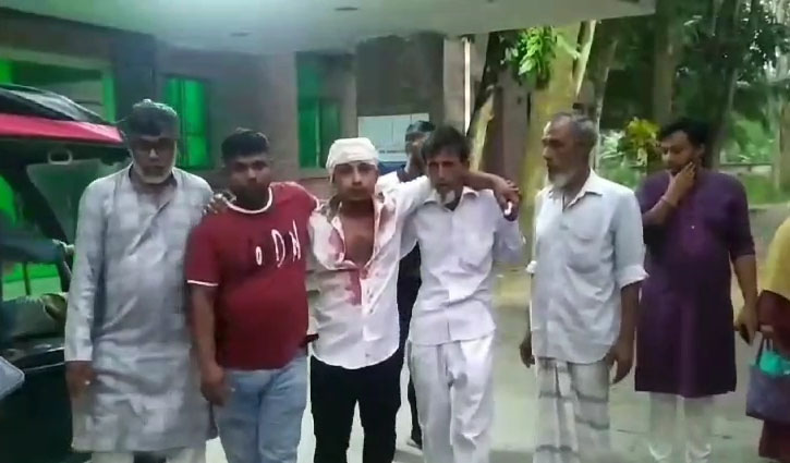 লৌহজংয়ে নির্বাচনি ক্যাম্পে প্রতিপক্ষের হামলা, আহত ১