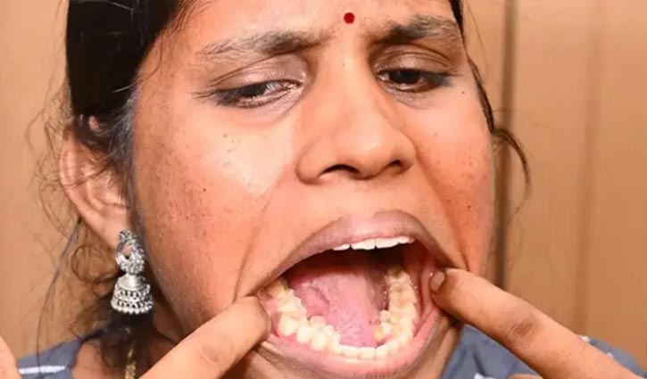 ৩৮ দাঁতের মানুষ ৩৮ দাঁতের মানুষ
