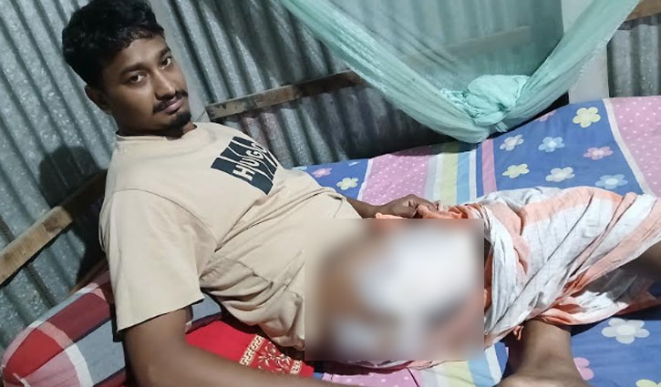 চিকিৎসার অভাবে বিছানায় যন্ত্রণায় কাতরাচ্ছেন দেলদুয়ারের মতিয়ুর