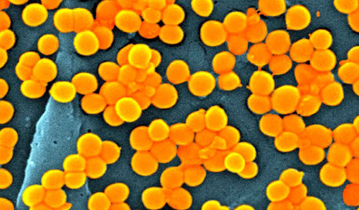 Deaths from antibiotic-resistant infections may increase by 70%