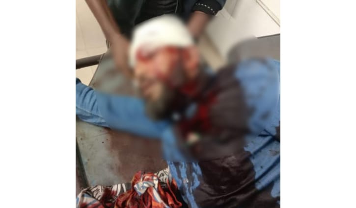 খুলনায় শ্রমিক শক্তির নেতার মাথায় গুলি