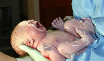 জন্মের পরেই শিশু কান্না করে কেন? জন্মের পরেই শিশু কান্না করে কেন?