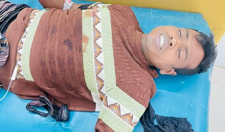 খুলনায় বাড়ি থেকে ডেকে নিয়ে যুবকের কব্জি কর্তন