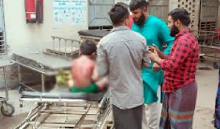 আশুলিয়ায় গ্যাস সিলিন্ডার বিস্ফোরণ, শিশুসহ দগ্ধ দম্পতি