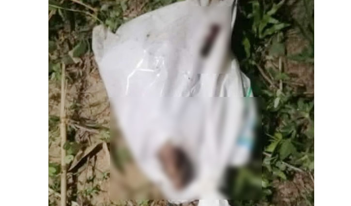 রামুতে পলিথিনে মোড়ানো পা উদ্ধার