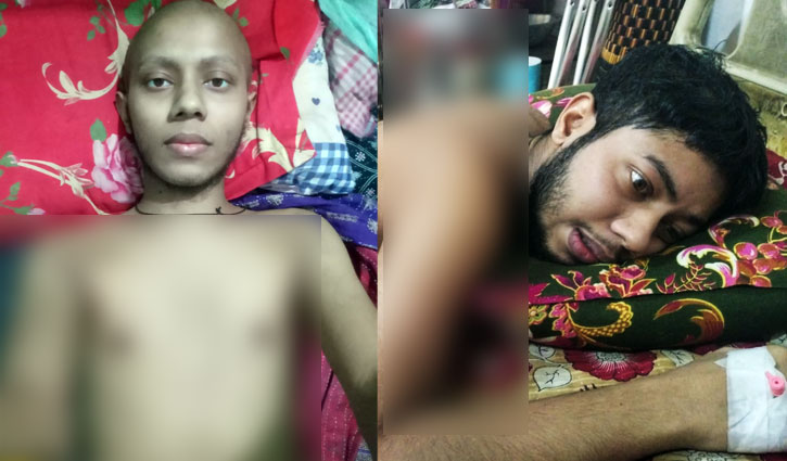ক্যান্সারের থাবায় মৃত্যুমুখে ইব্রাহিম, দিশেহারা পরিবার ক্যান্সারের থাবায় মৃত্যুমুখে ইব্রাহিম, দিশেহারা পরিবার