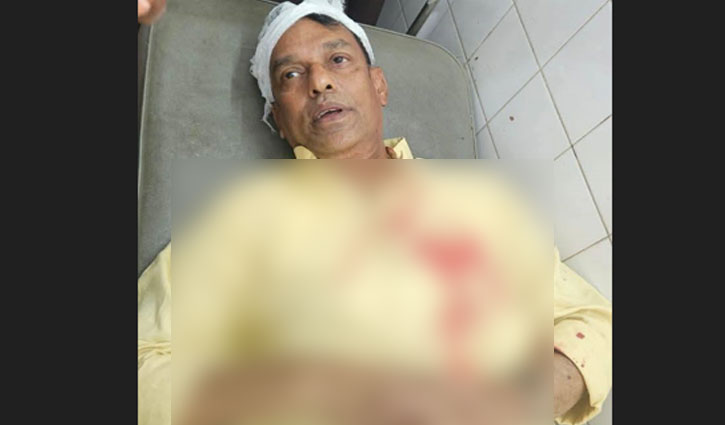 বিএনপি নেতাকে হাতুড়িপেটার অভিযোগ শিবিরের বিরুদ্ধে