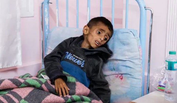 Israel kills at least 31 in Gaza as aid blockade starves children