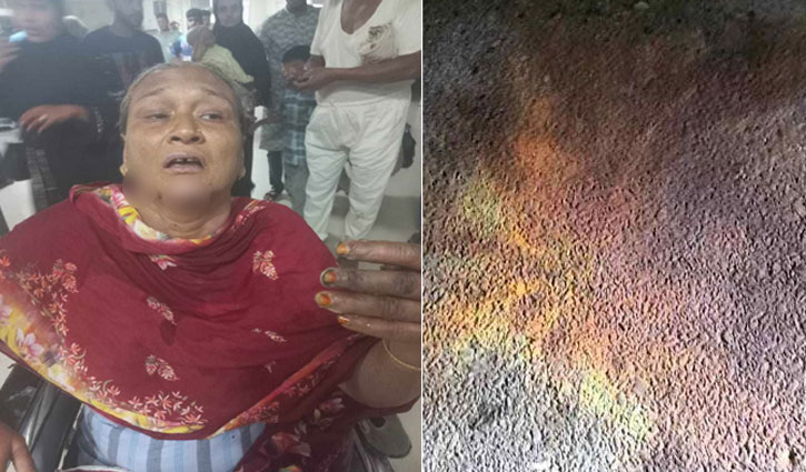 Petrol bomb attack on auto-rickshaw in Ctg, 2 burnt