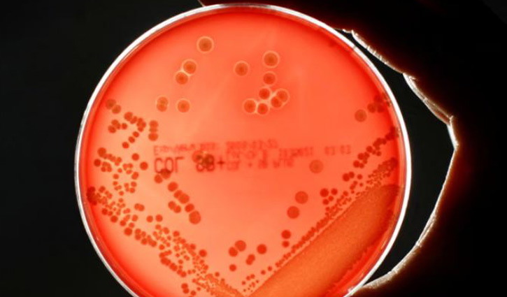 সুপারবাগের কারণে বিশ্বব্যাপী মারা যাবে লাখ লাখ মানুষ