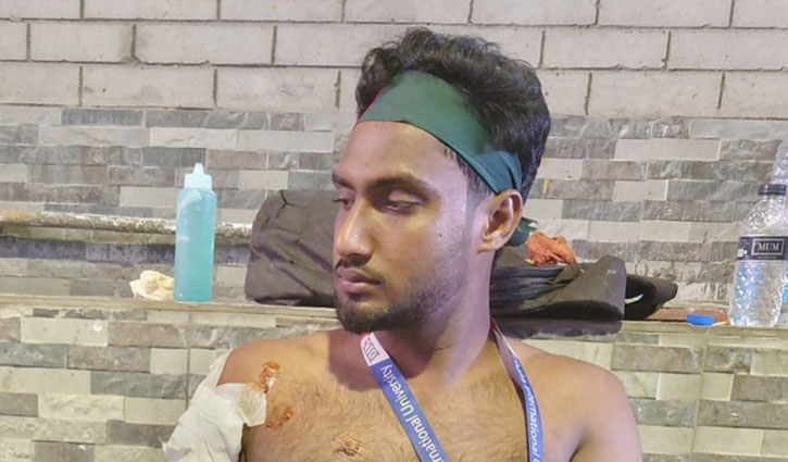 নতুনবাজারের সেই রনির বুলেটের যন্ত্রণা আজো থামেনি