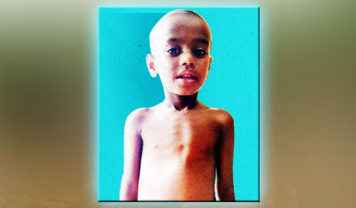 জিসানকে বাঁচাতে দরকার ৯ লাখ টাকা