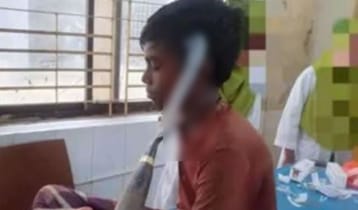 ২৬ ঘণ্টা পর মাথা থেকে কাস্তে অপসারণ