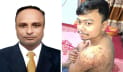 জুলাই আন্দোলনে আহত শিক্ষার্থীর চিকিৎসা করাবেন নজরুল বিশ্ববিদ্যালয়ের কর্মচারী