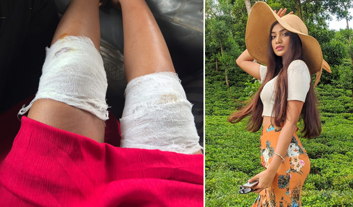 শুটিং সেটে আহত সুনেরাহ