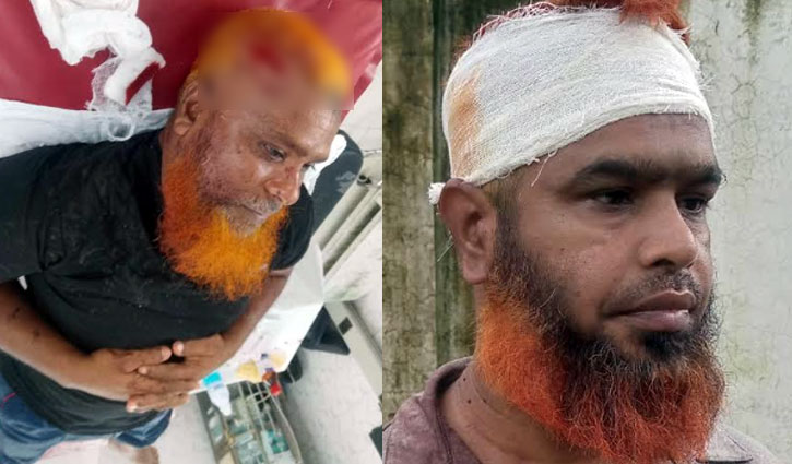 ধামরাইয়ে জমি নিয়ে বিরোধে ২ ভাইকে কুপিয়ে জখম ধামরাইয়ে জমি নিয়ে বিরোধে ২ ভাইকে কুপিয়ে জখম