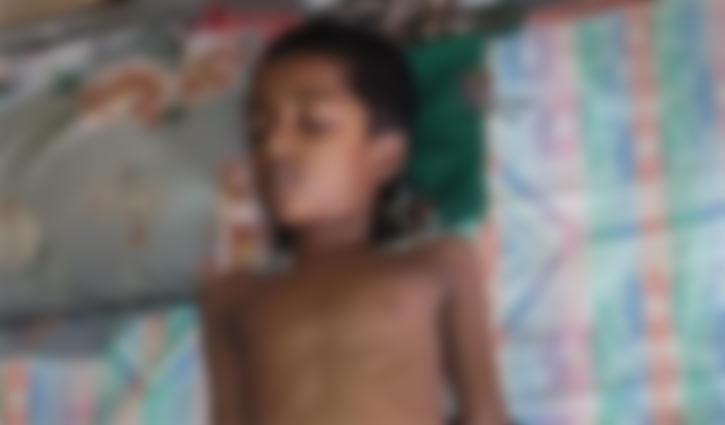 উখিয়ায় লেকে ডুবে রোহিঙ্গা শিশুর মৃত্যু
